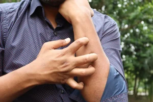 woman scratching arm